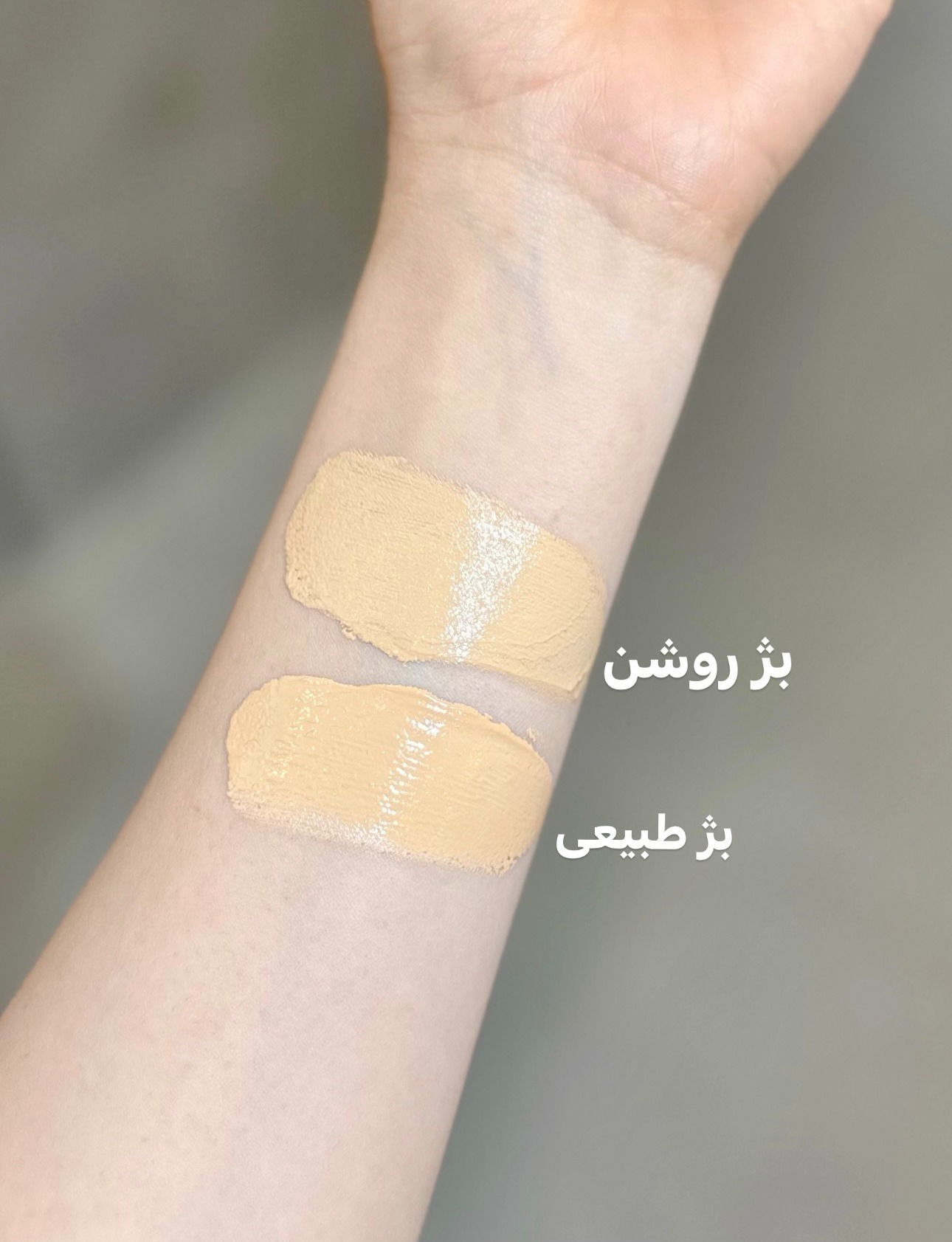 کرم مناسب پوست های دارای جوش رنگی طبیعی ژیناژن